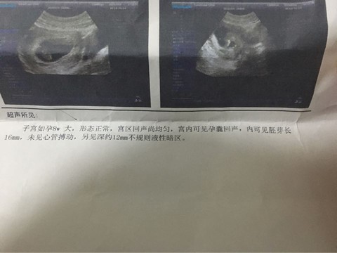 journal_insert_pic_492782909