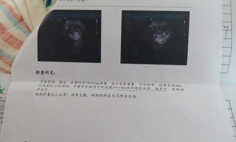 journal_insert_pic_493300540