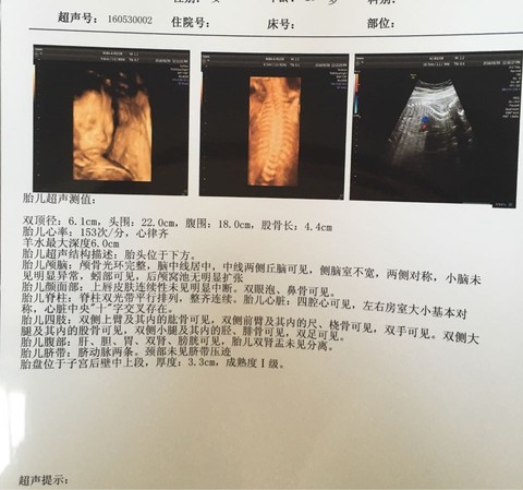 journal_insert_pic_495806519