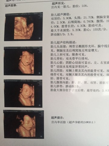 journal_insert_pic_496533800