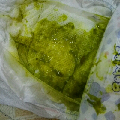 宝宝五个月,平时一天一次大便.这几天一天四次,拉的都是绿色便便.