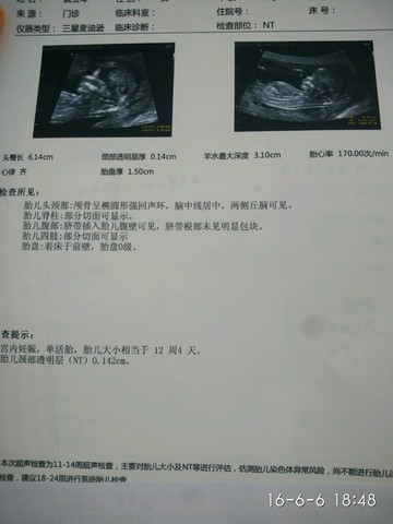 journal_insert_pic_499553122