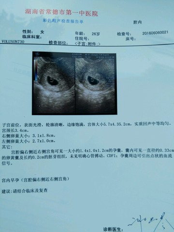 journal_insert_pic_499305612