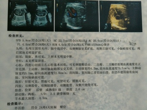 journal_insert_pic_499517423