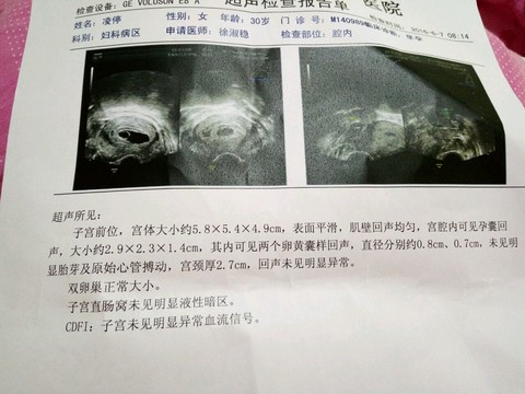 journal_insert_pic_500528555