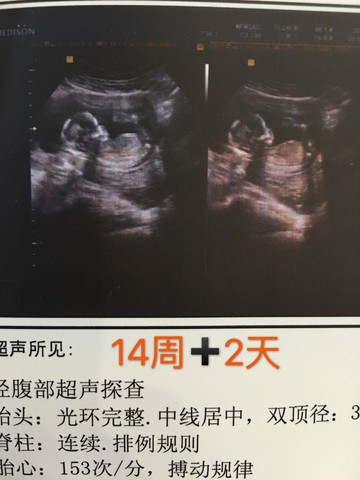 journal_insert_pic_502215716