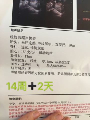 journal_insert_pic_502215738
