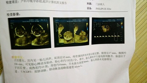 journal_insert_pic_505216643
