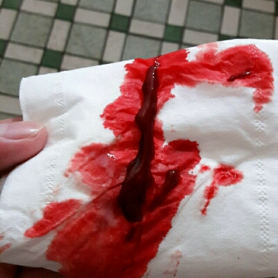 问答 怀孕期 大名胡逸帆孕34周3天2016-06-14 推荐回答