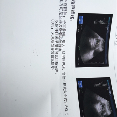 journal_insert_pic_509363648