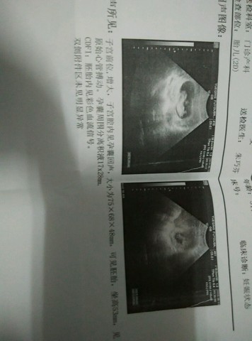 journal_insert_pic_513832018