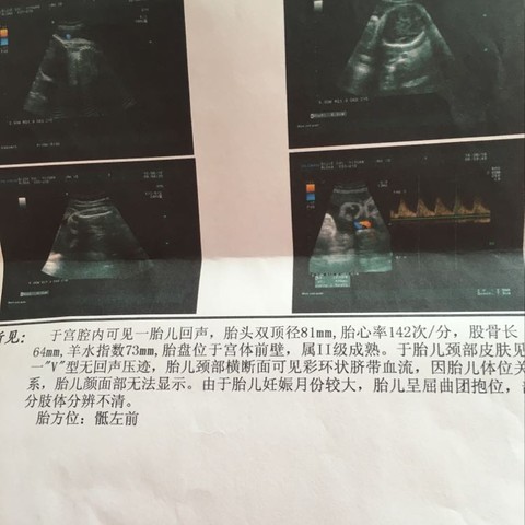 journal_insert_pic_514421424