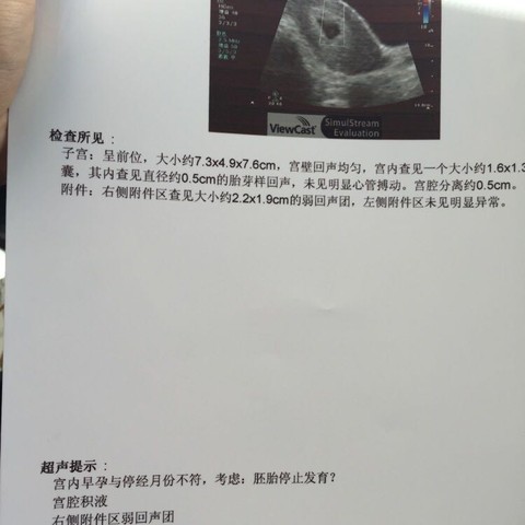 journal_insert_pic_516763412