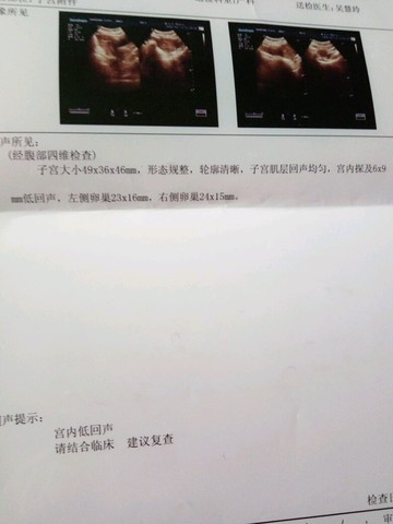 journal_insert_pic_520613435