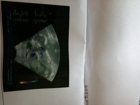 journal_insert_pic_522669116