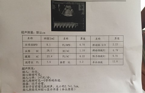 journal_insert_pic_523900881