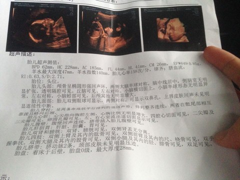 journal_insert_pic_526900517