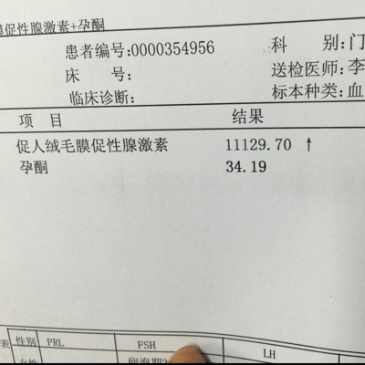 一个月以内检查了4次 一直没照到宝宝 阴超没有发现宫外孕