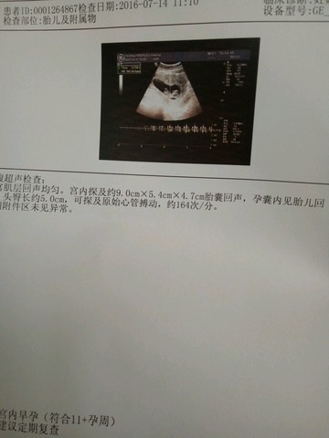journal_insert_pic_529454523