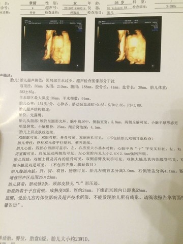 journal_insert_pic_530478627