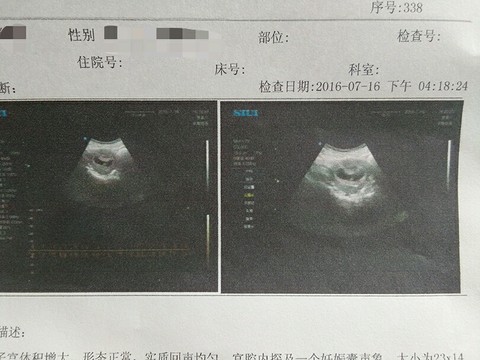 journal_insert_pic_531330075