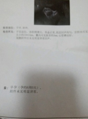 journal_insert_pic_531880040