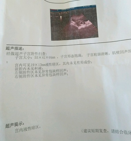 journal_insert_pic_532453718