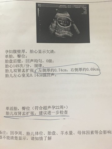 journal_insert_pic_533742864