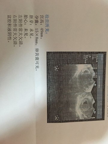 journal_insert_pic_534466071