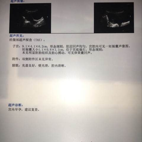 journal_insert_pic_534885825