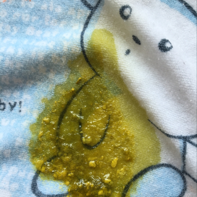 宝宝出生四个月了,纯母乳餵养,最近大便都是这个样子是怎麼回事