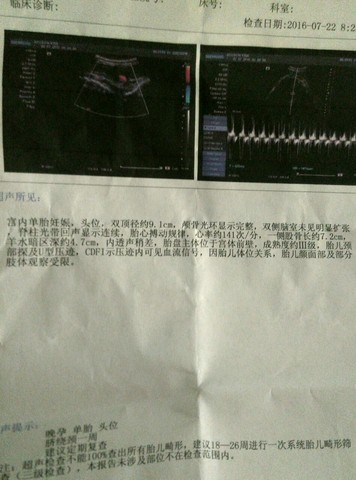 journal_insert_pic_537153499