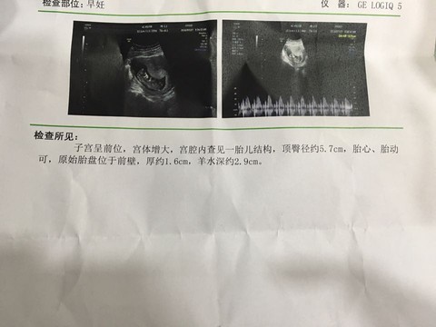 journal_insert_pic_539096495