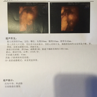 journal_insert_pic_540460716
