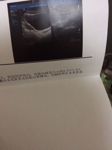 journal_insert_pic_541074372