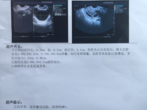 journal_insert_pic_542434423