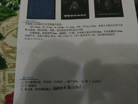 journal_insert_pic_586931313