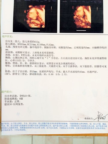 journal_insert_pic_620698875