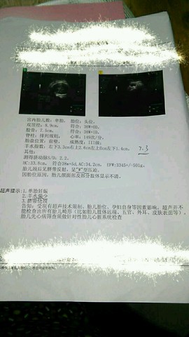 journal_insert_pic_643607703