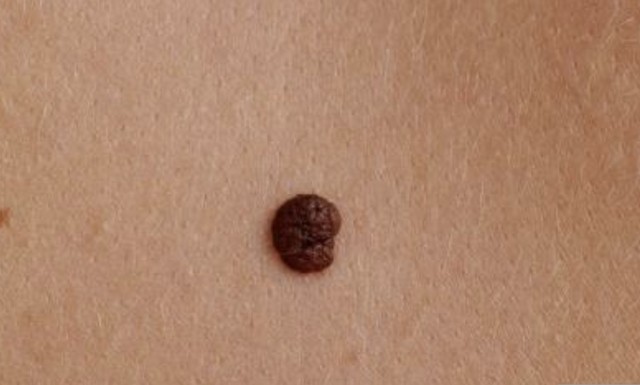 QQ20170712-154756@2x.jpg