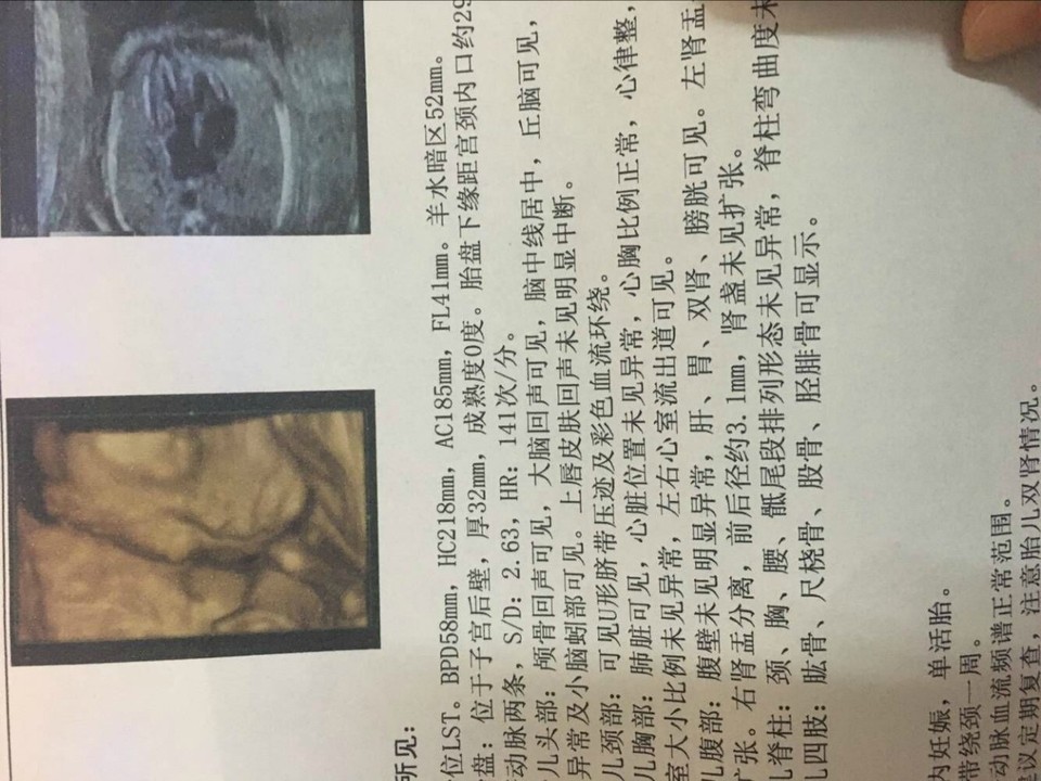 journal_insert_pic_804329481